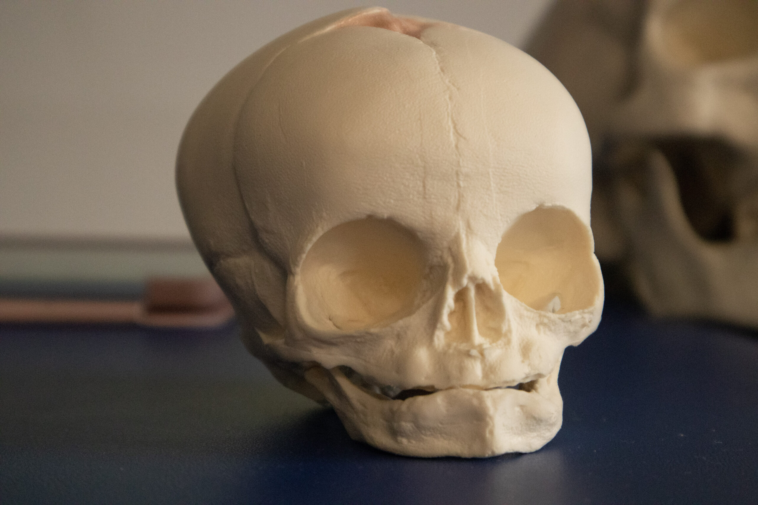 szkolenia z osteopatii i fizjoterapii niemowląt