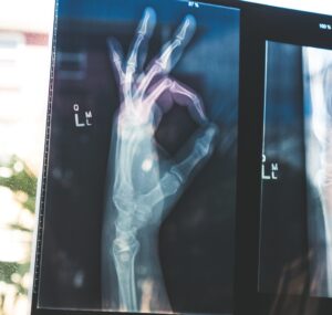 Czy kości są unerwione